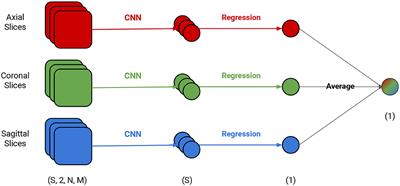 Predicting Brain Age at Slice Level: Convolutional Neural Networks and Consequences for Interpretability